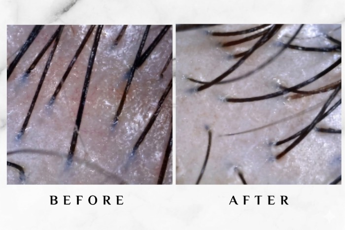 Scalp look less red and inflamed after treatment.