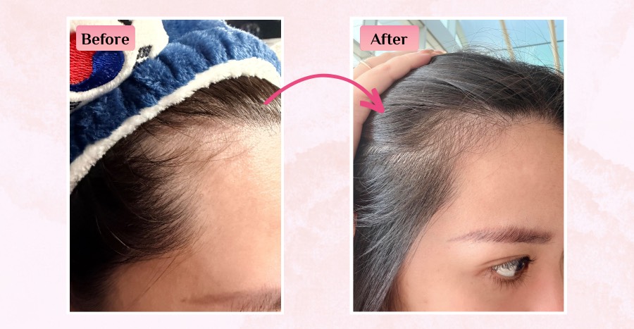 MY SAO anti-hair loss essence reviews