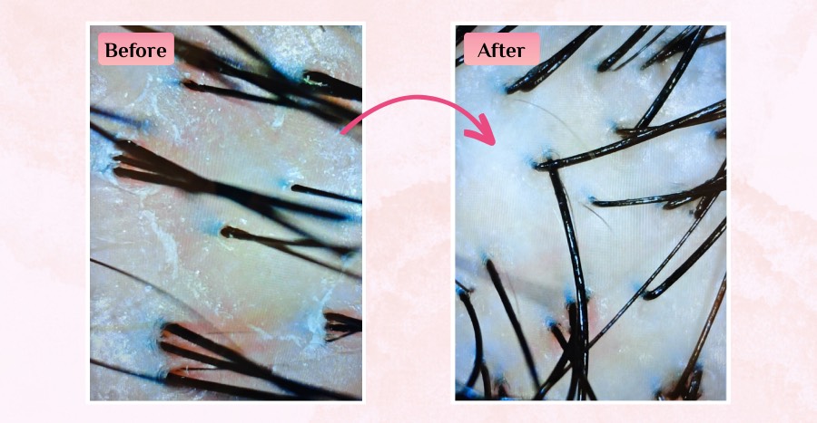 Beijing 101 scalp treatment