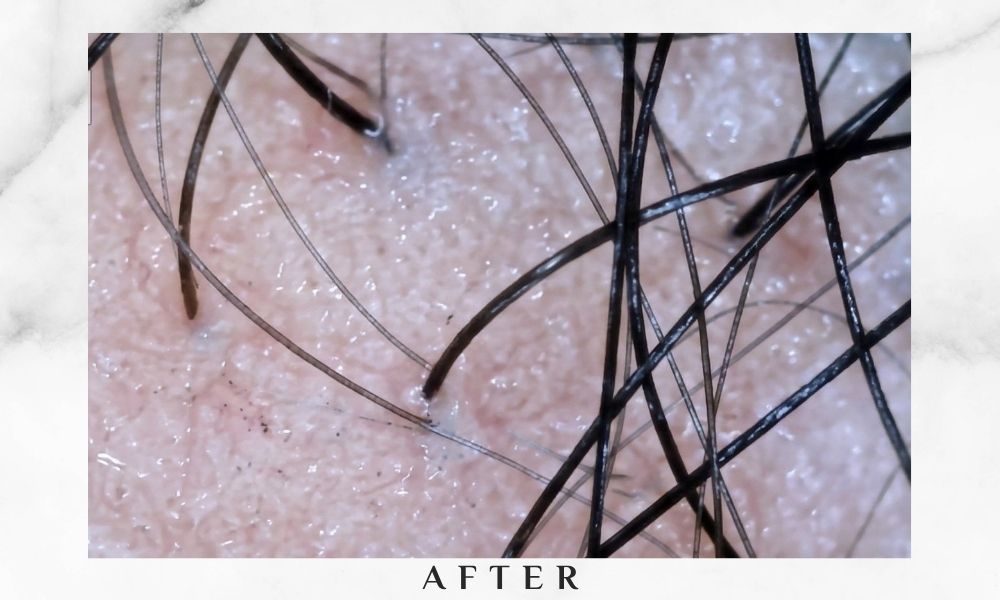 beijing 101 sam after