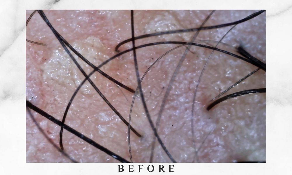 beijing 101 sam before