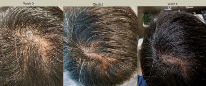 miriqa hair supplement review