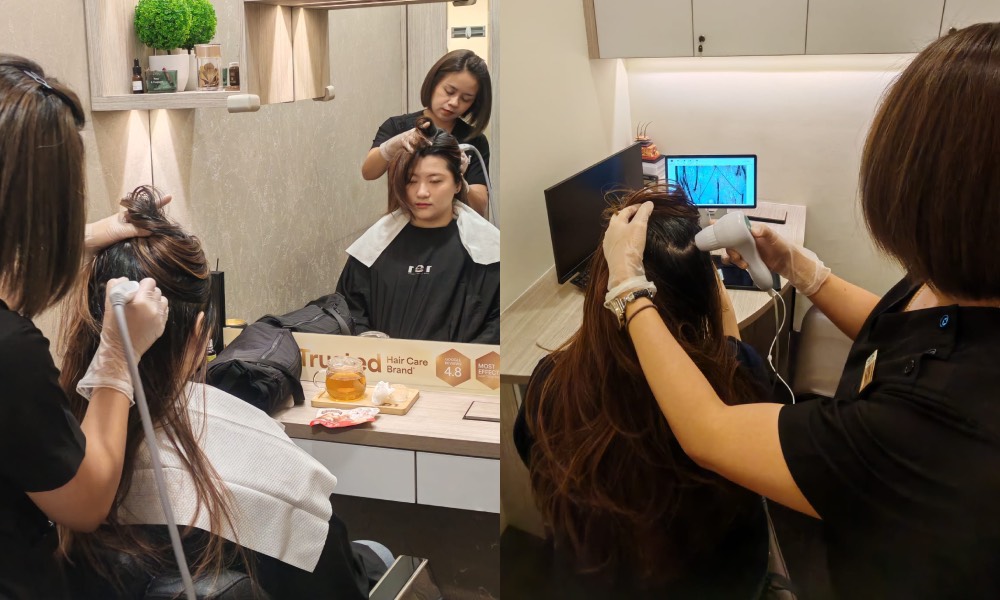 Beijing 101 - scalp analysis scan