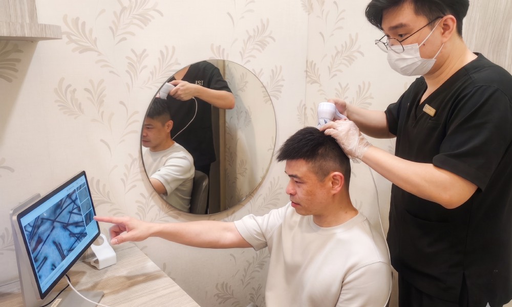 Beijing 101 - scalp analysis