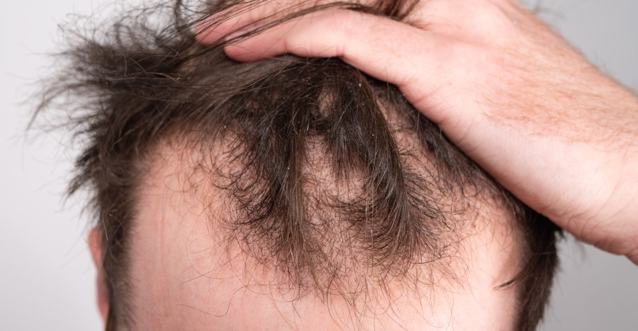 miriqa hair supplement