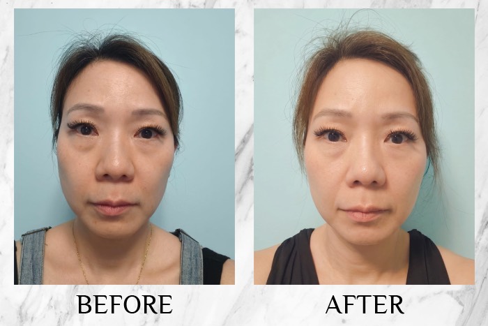 irise collagen glow shot review