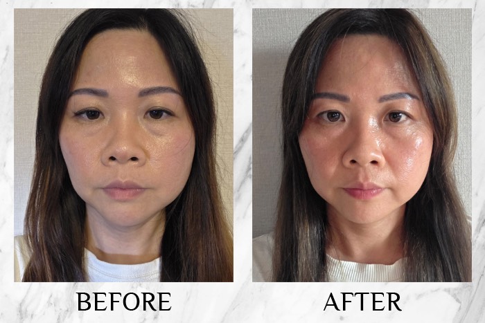 Irise Collagen Glow Shot - before/after