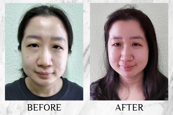 Irise Collagen Glow Shot - before/after