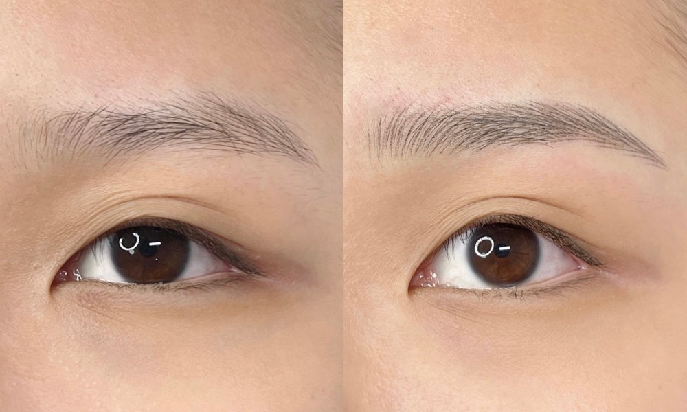 The Beaute Canopy - brow