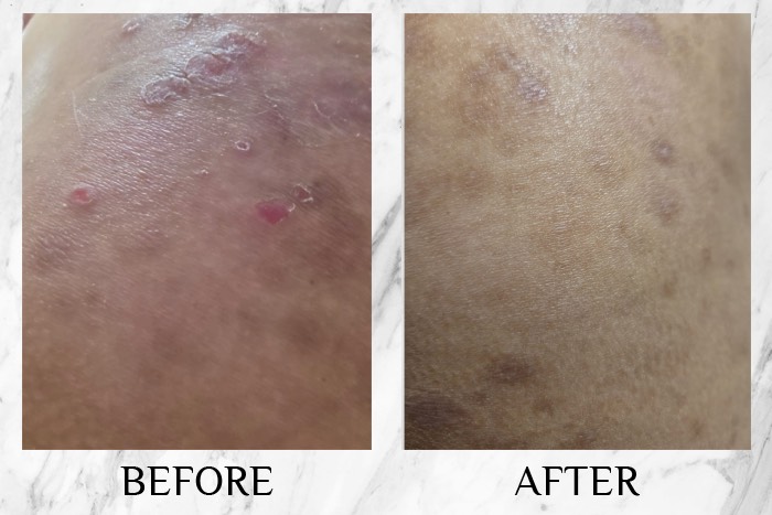 Ci labs eczema relief cream