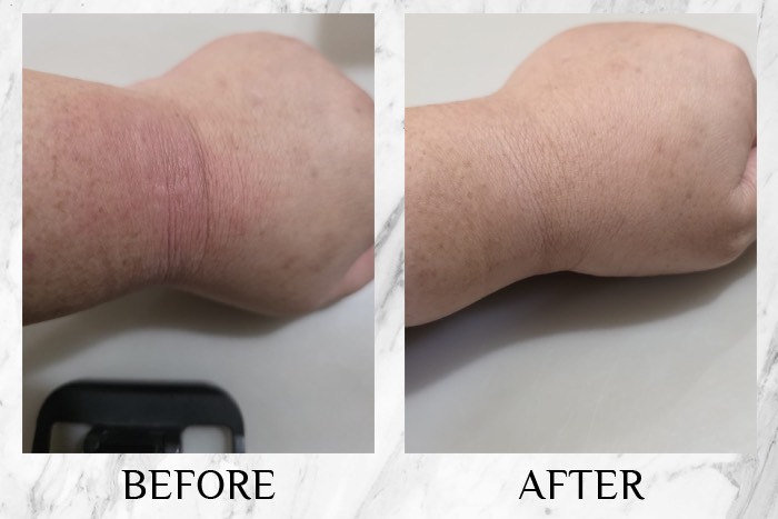 CI Labs Eczema Relief Cream - Eugenia