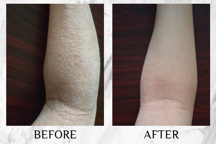 CI Labs Eczema Relief Cream - Michelle