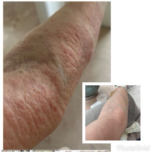 CI Labs Eczema Relief Cream