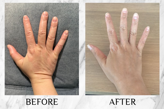 CI Labs Eczema Relief Cream - Ng Shiyun