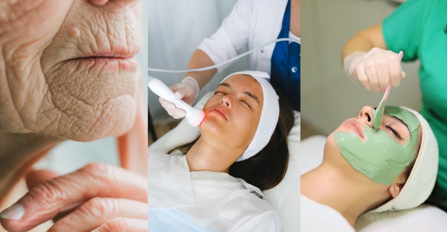 DVBTA Anti ageing facial