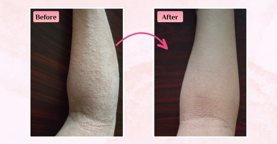 CI Labs Eczema Relief Cream