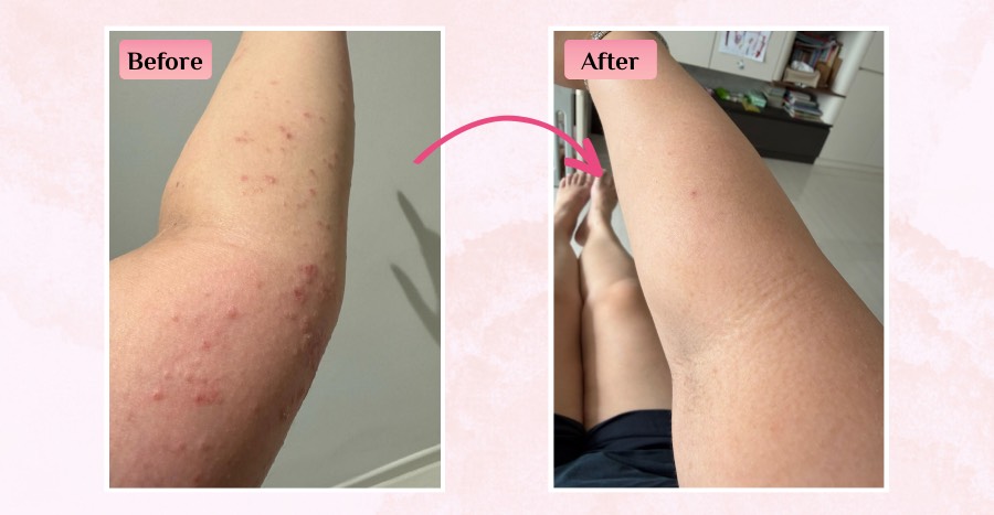 MIRIQA® Dermabiotics™