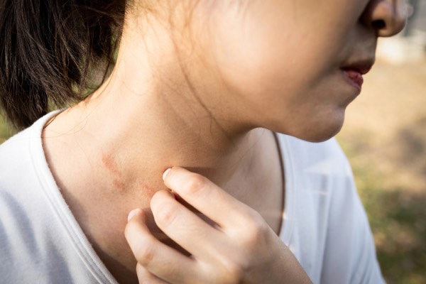 MIRIQA® Dermabiotics™