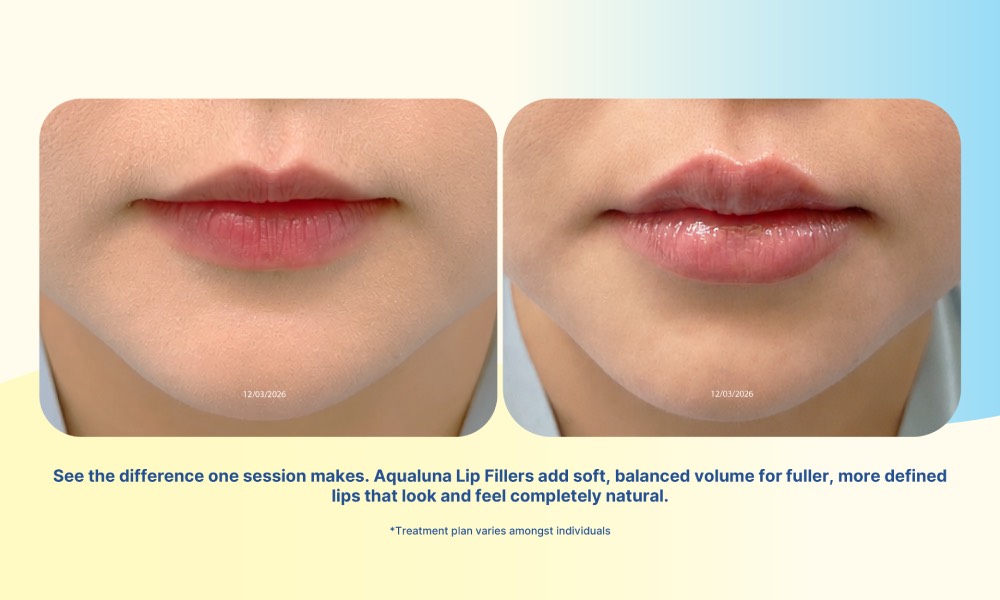 ReDERM Clinic Bangkok - lips