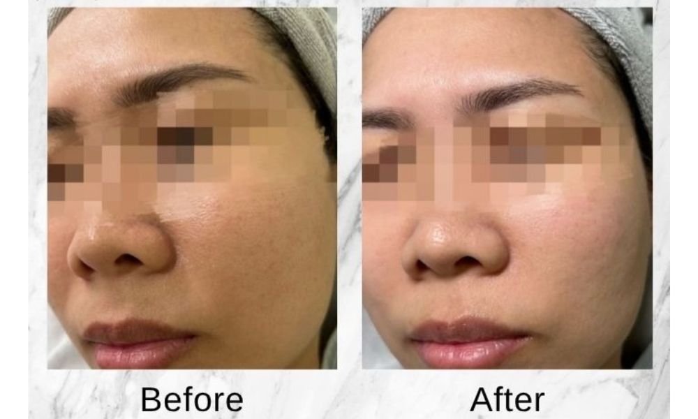 beforeandafterhanguk