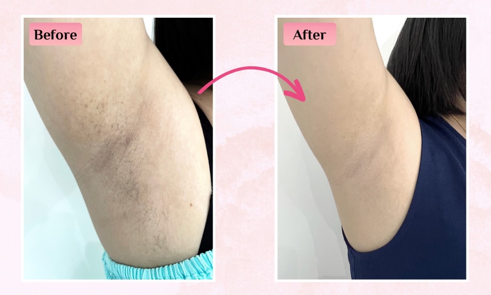 Japan IPL - DVBTA26 - before_after