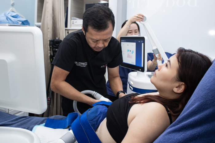 coolsculpting elite review2
