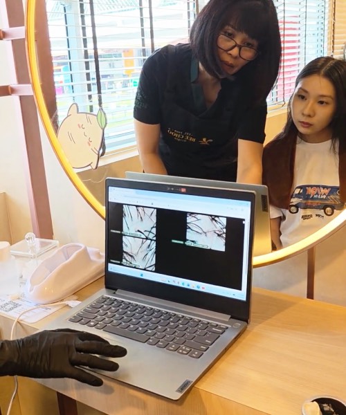 scalp analysis