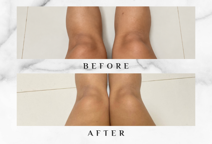 dove body scrub
